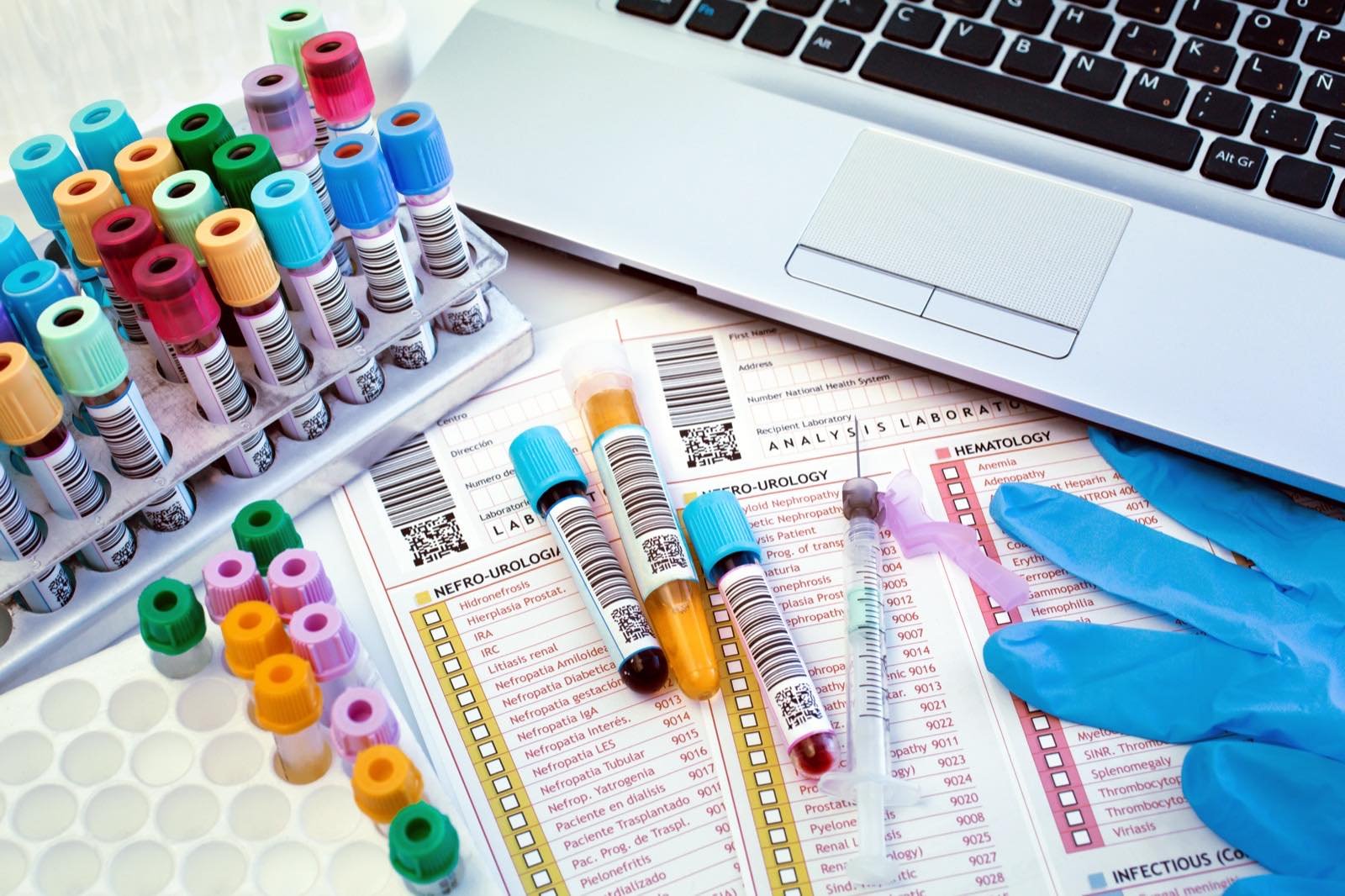 Racks of color-capped specimen collection tubes and barcoded culture tubes resting on a laboratory analysis requisition form beside a gloved technician's hand